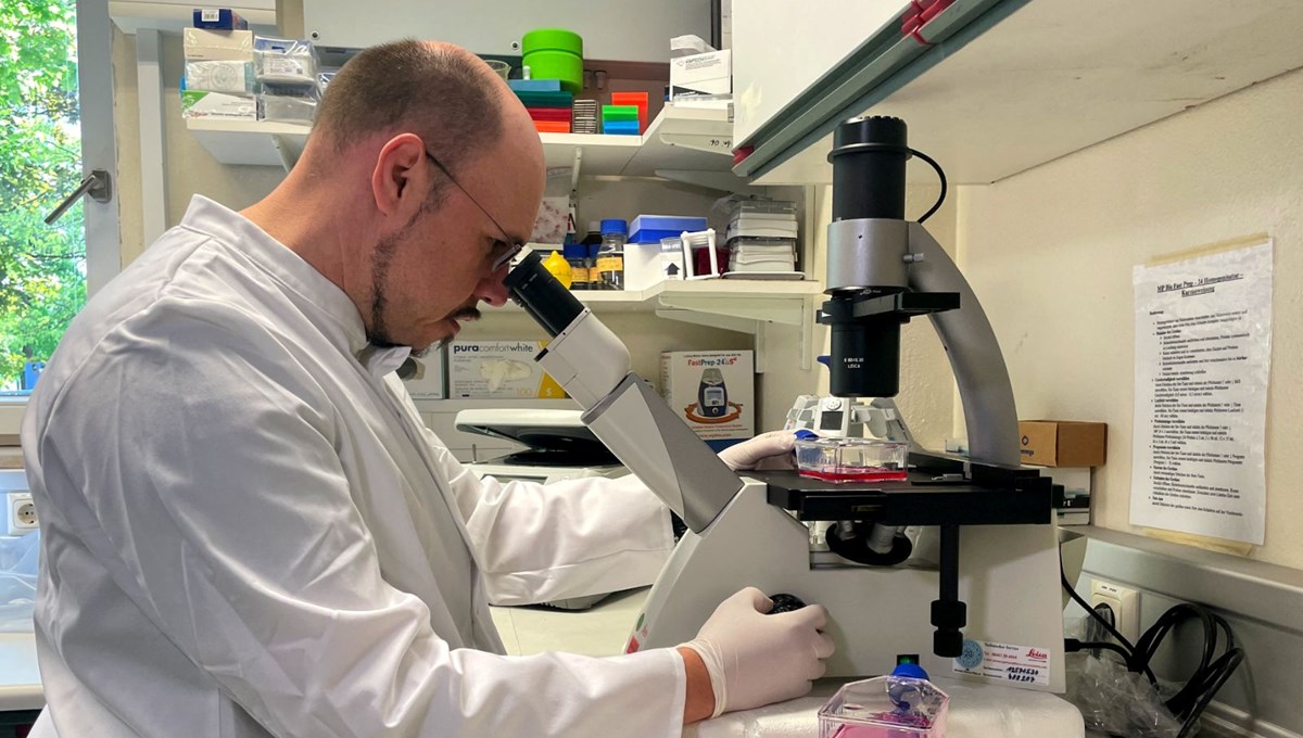 DSÖ’den sperm örneklerinde maymun çiçeği virüsü bulunan hastaları araştırdığını duyurdu: Maymun çiçeği cinsel bir hastalık mı?