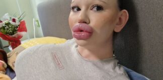 Dünyanın en büyük dudaklı kadını Andrea Ivanova: Yeni bir rekor istiyorum