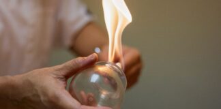 Hacamat nasıl yapılır? Hacamat ne zaman yapılmalıdır? Kimler yaptırabilir?