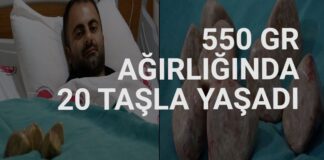 Karın ağrısıyla hastaneye gitti mesanesinden çıkanlar şaşırttı