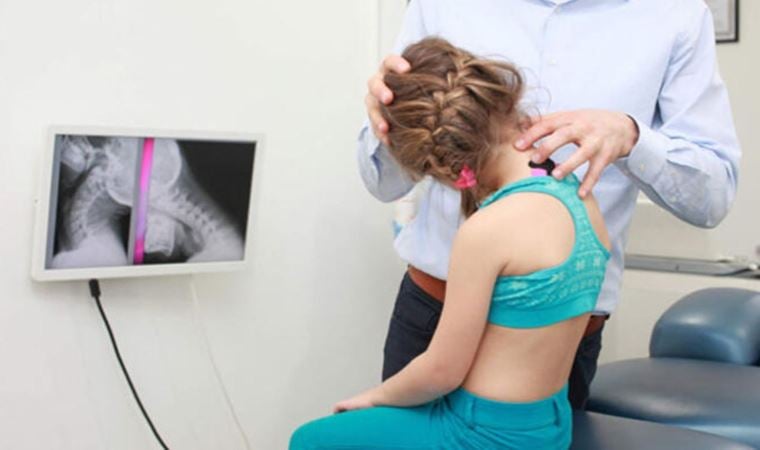 Skolyoz tedavisinde yeni yöntem: ‘İpli tedavi’
