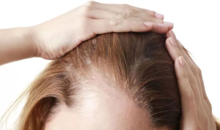 Cildiye uzmanı uyardı: ‘Saçkıran olan bölgeye sarımsak veya jilet sürmeyin’