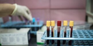 DSÖ’den Covid-19’un yeni varyantları karşısında “daha fazla test” çağrısı