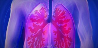 Polonya’da lejyonella bakterisi nedeniyle ölenlerin sayısı 16’ya yükseldi