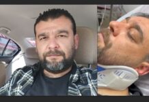 İYİ Parti Keçiören Meclis Üyesi Adayı Erhan Altınok Saldırıya Uğradı